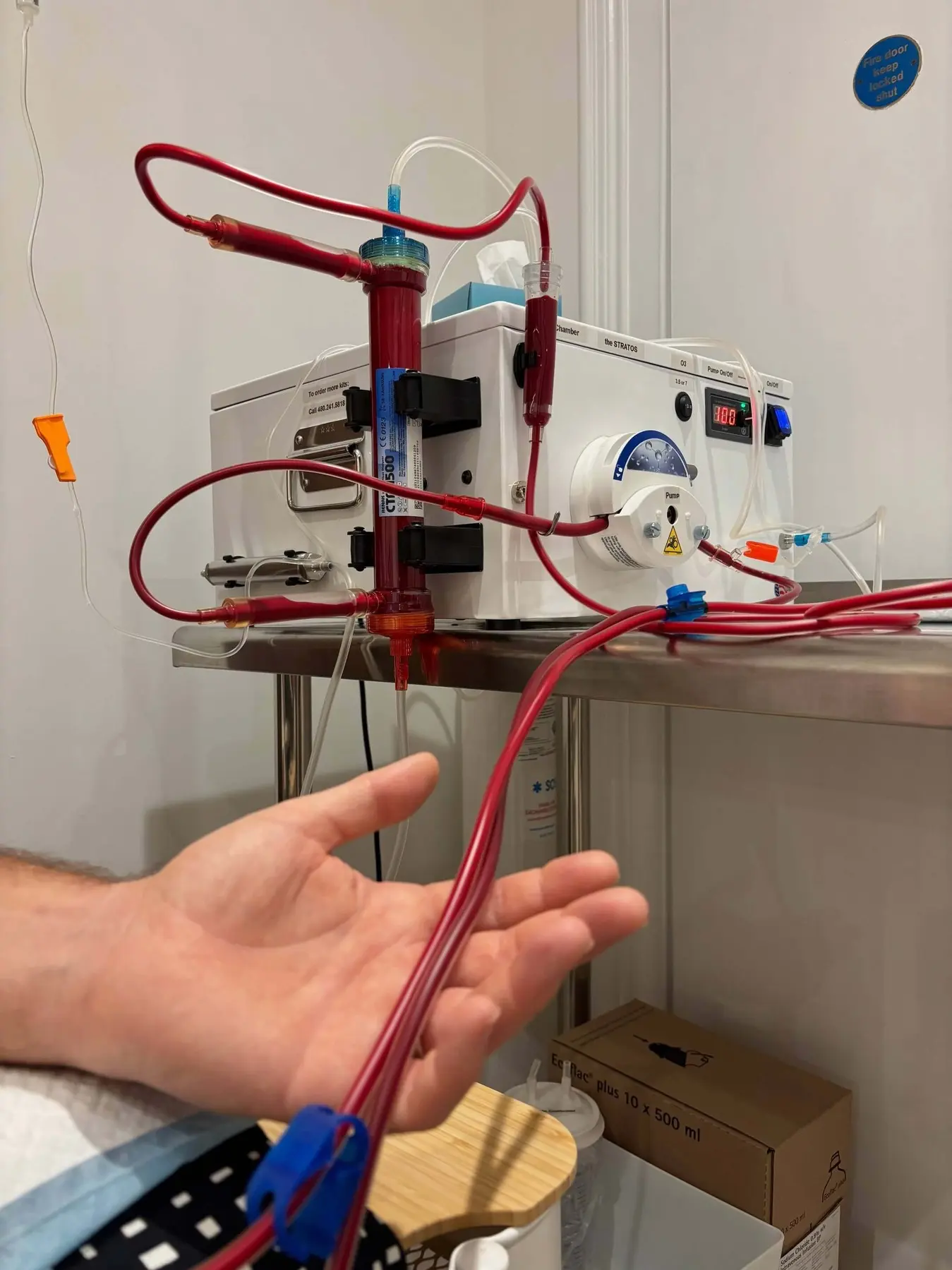 eboo-machine-portait Procedimiento médico renal con máquina de diálisis.