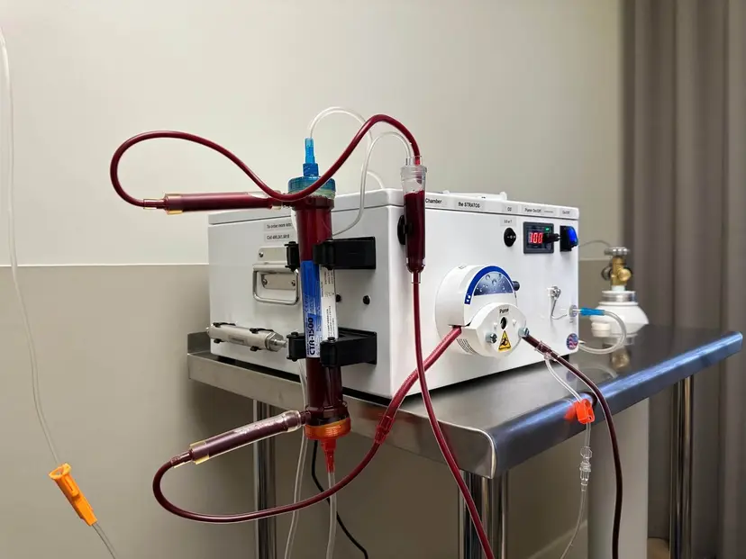 Máquina de terapia médica con tubos conectados.